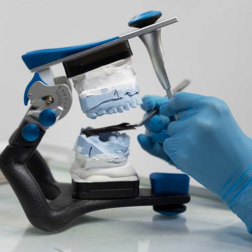 Dental-Prostheses-stomer-2 Dental-Prostheses-stomer-2