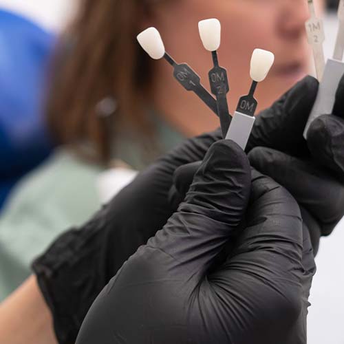 dental-veneers-stomer-1