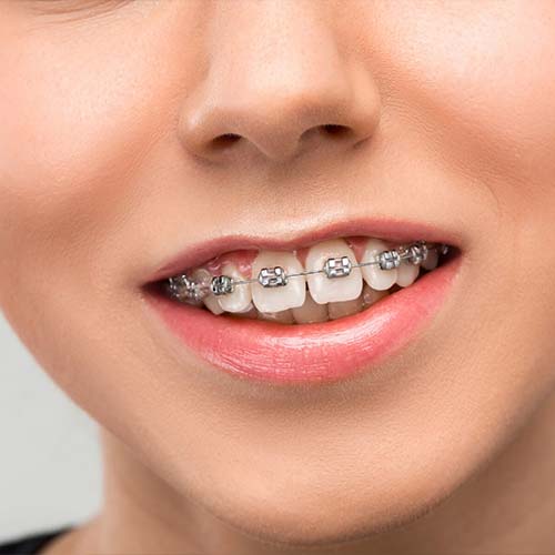 orthodontics-1-stomer Dental-Prostheses-stomer-2