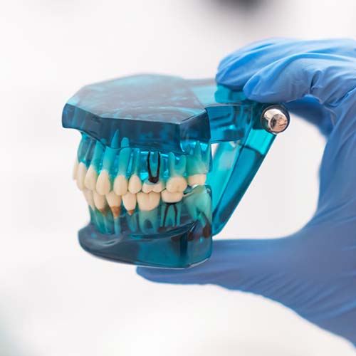 Dental-Prostheses-stomer-1 Dental-Prostheses-stomer-1